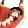 Dental Sectional Matrices Clip Matrix System NITI and Peek Material Ring Matrix Bands Dentistry Instrument Tool