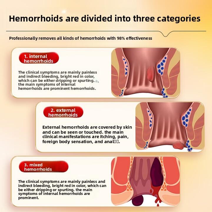 Powerful Hemorrhoid Cream for Severe Anal Pain - Fast Acting Itch Relief, Reduces Inflammation - Soothing Formula 55g