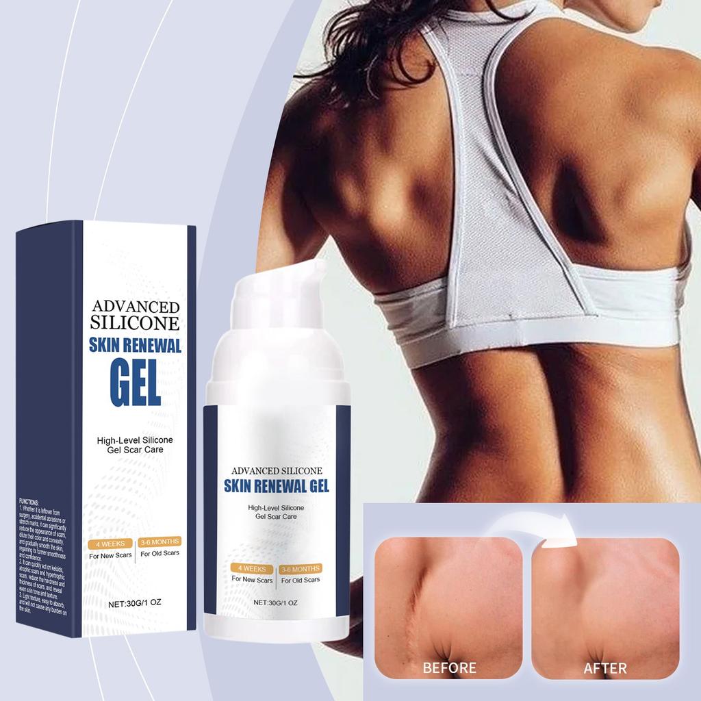Advanced Silicone Skin Gel Gentle Moisturizing And Lightening Stretch Marks Lighten Fine Lines And Remove Skin Smoothing Gel,30g