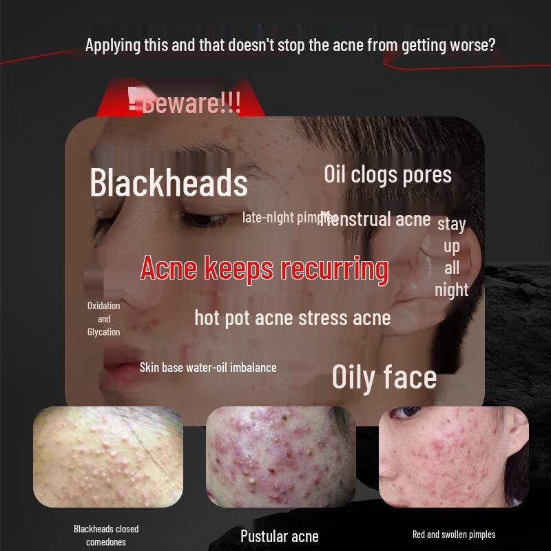Tongrentang Acne & Oil Control Amino Acid Facial Cleanser