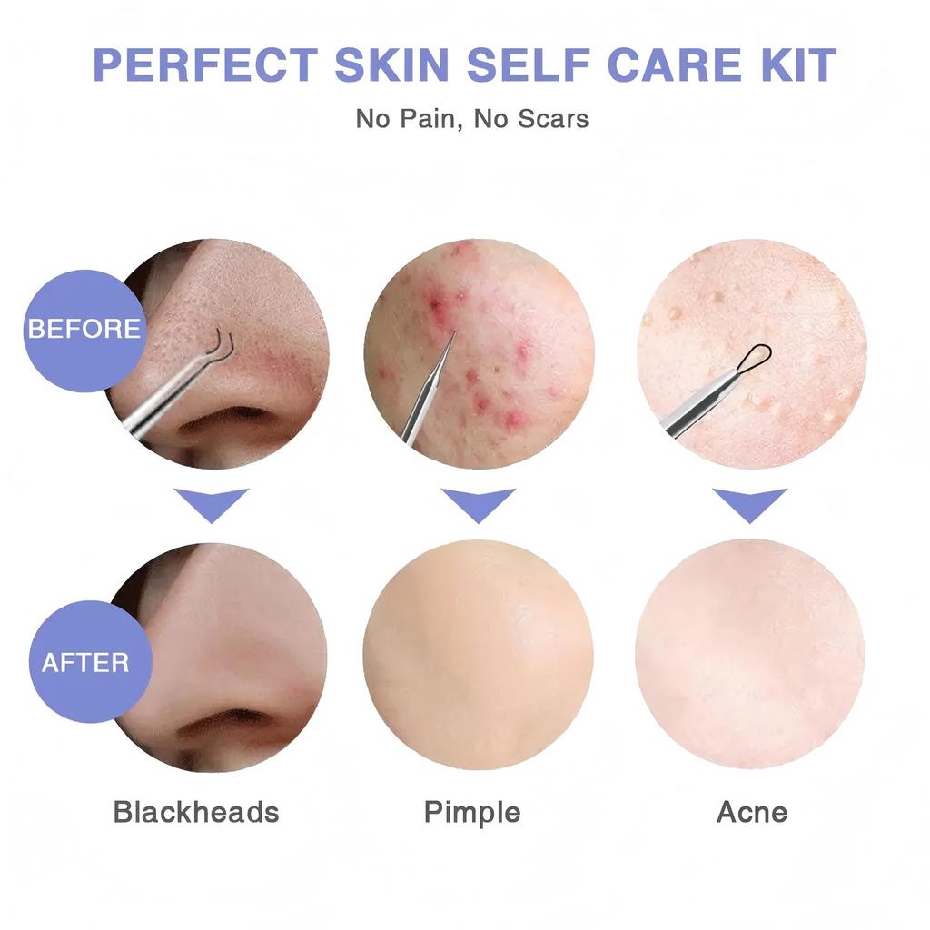 Xiaomi Electric Pore Cleaner & Blackhead Remover, Professional Deep Cleansing Vacuum Device for Facial Skincare, Pore Refining Tool