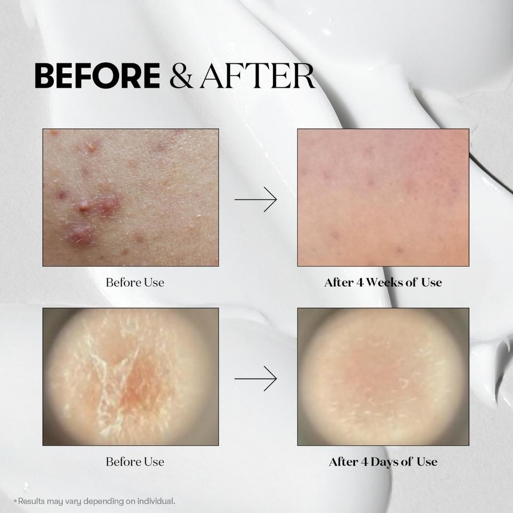 [VT COSMETICS] Reedle Shot 100 Essence + Cleanser (50ml + 80ml / 1.69 fl. oz + 2.70 fl. oz)