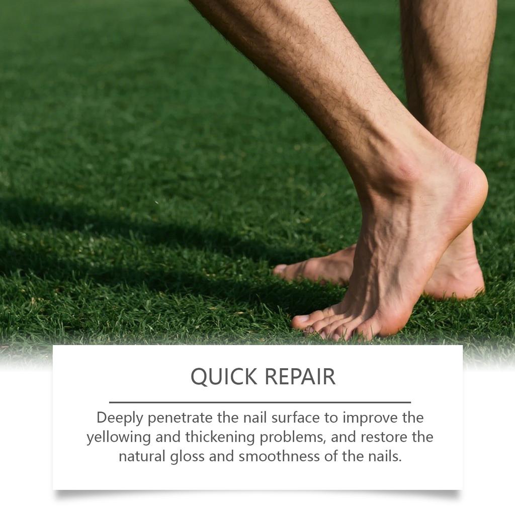 Nagelpflegespray, Nagelpflege, Zehennagelflüssigkeit, Weiche Nagelverdickungscreme, Nagelpolitur Aufhellungs-Spezial, Eingewachsener Nagel Granulationspflege, 100ML