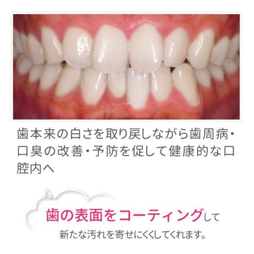 Dental White Proism Polyrin Bubble: Set of 4: Toothpaste Gel [Teeth Whitening at Home, Toothpaste Whitening]