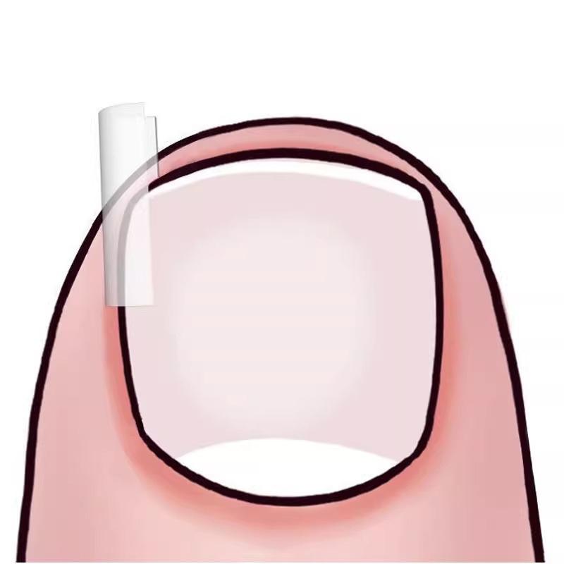 50Pcs Ingrown Toenail Correction Tool Ingrown Toe Nail Treatment Elastic Patch Sticker Straightening Clip Brace Pedicure Tool
