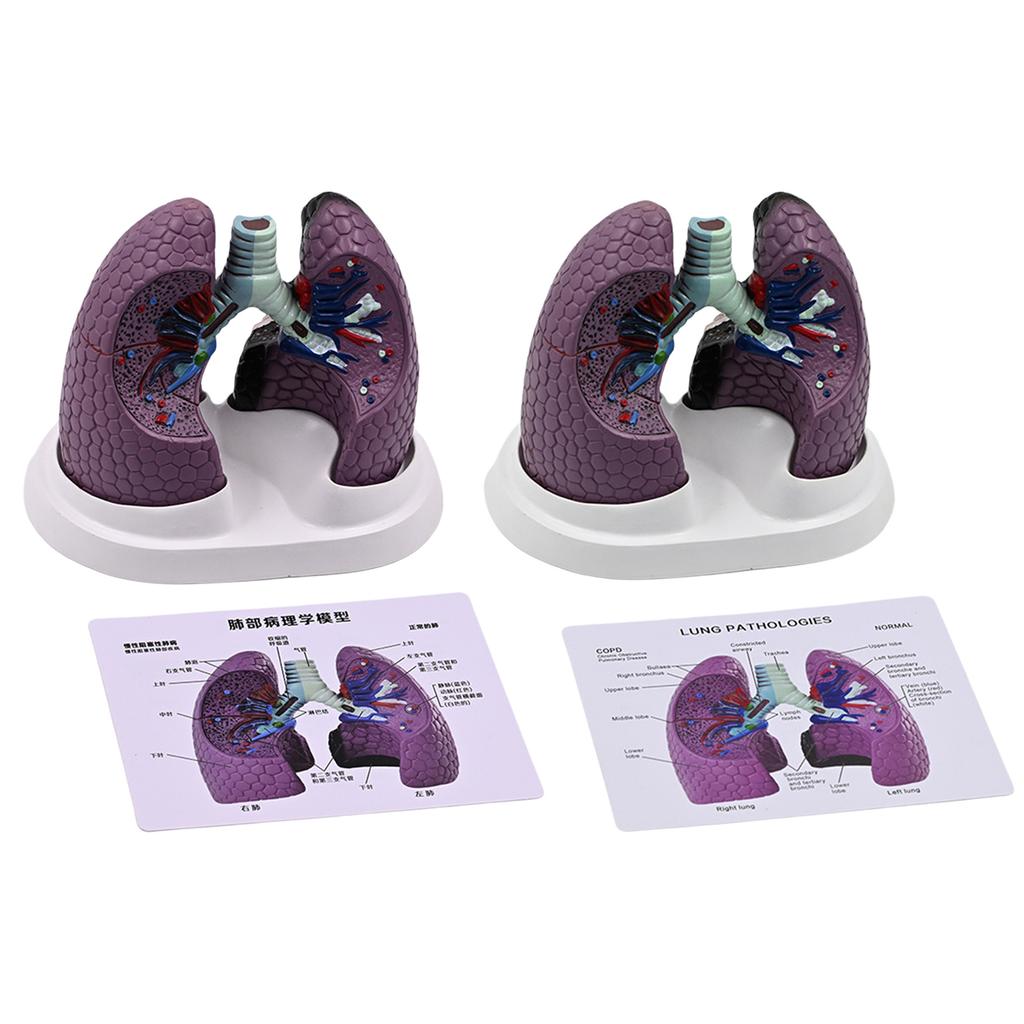 Anatomical Pathological Lung Model Human Lung Anatomy Model Normal and Pathological Lung Anatomy Model for Teaching Tool