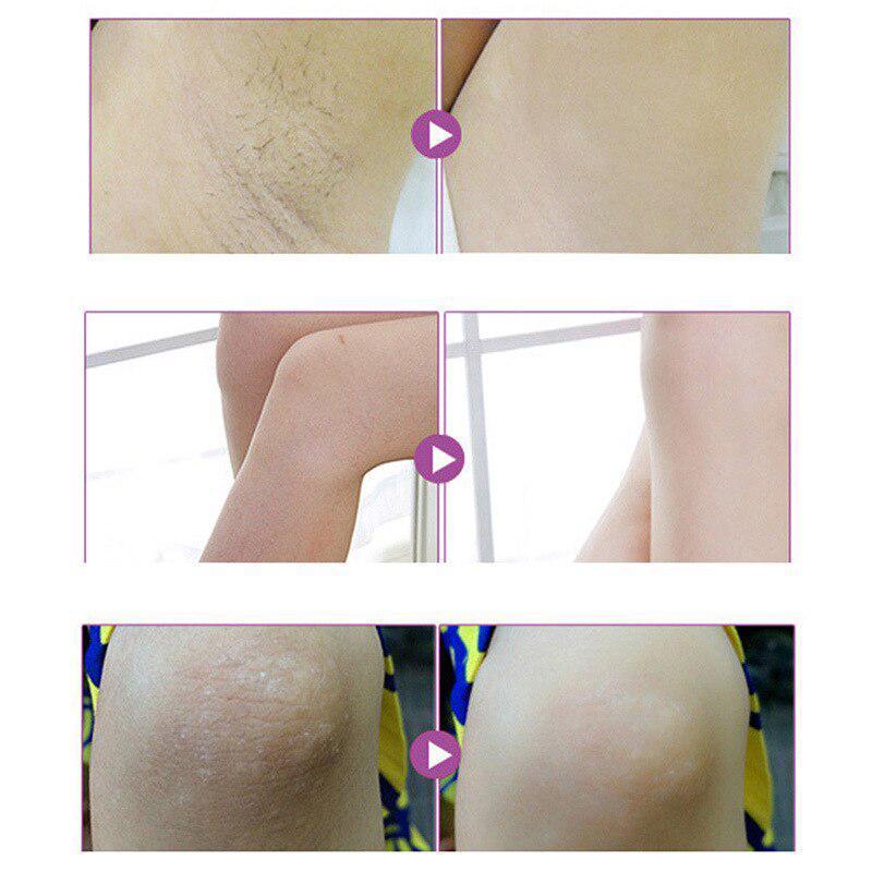 Crema Corpo Bellezza Crema Sbiancante Ascelle Tra Le Gambe Ginocchia Parti Intime Sbiancamento Ascella