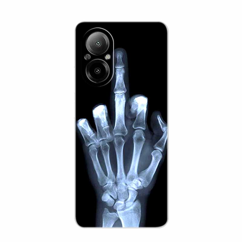 For Realme C67 4G Case 6.72" Clear Edge Silicone Soft TPU Phone Case For Realme C67 4G Back Cover Case RealmeC67 C 67 Funda Para
