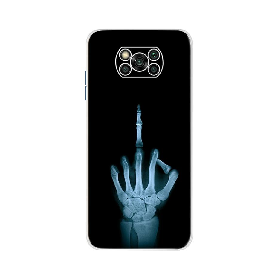 For Xiaomi Poco X3 Pro Back Cover 6.67" Cute Cat Patterns Transparent Bumper Cover For Xiaomi POCOX3 Pro POCO X 3 Cover Fundas