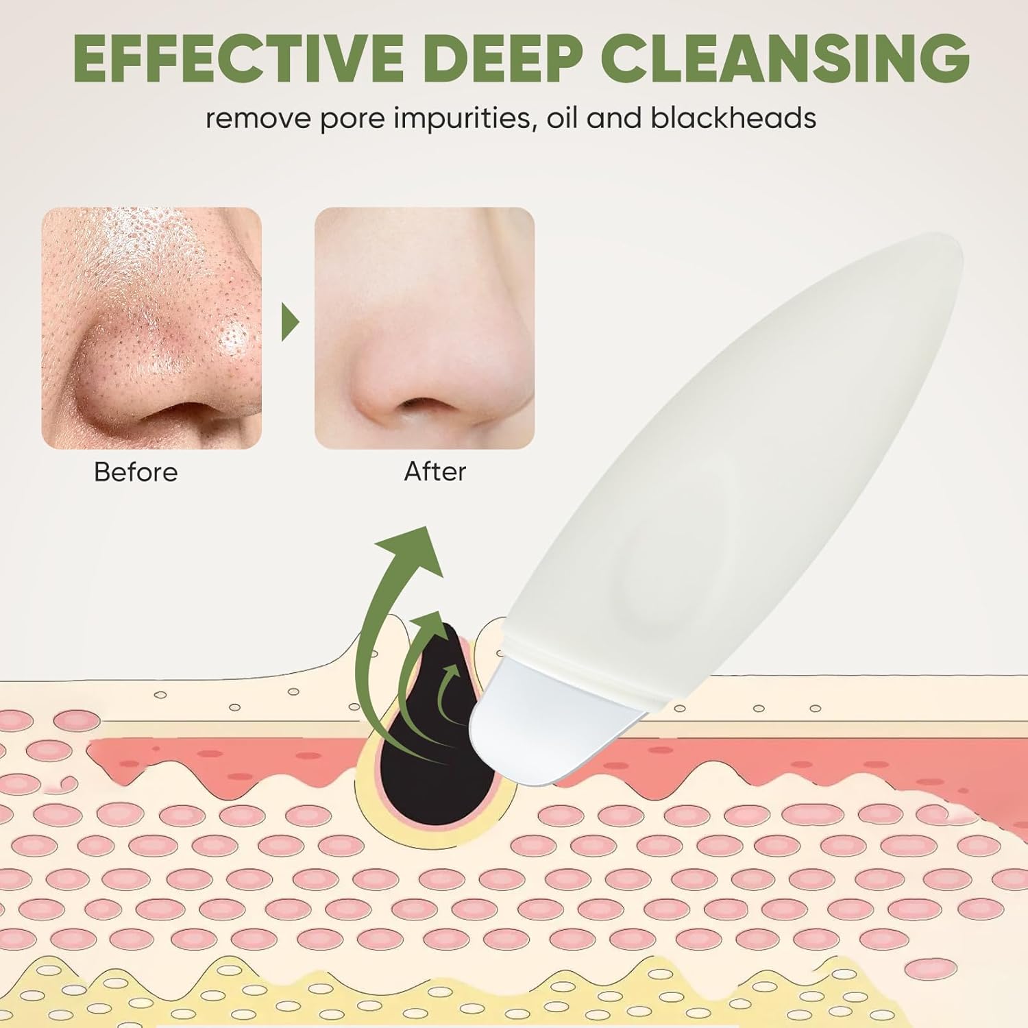 Blackhead Remover Tool, Face Spatula Skin Scrubber Facial Pore Cleaner Skin Care Tool Black Head Remover for Face Nose