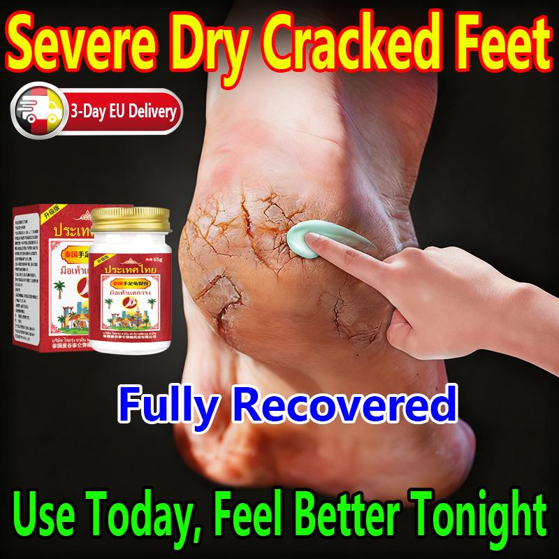 Cracked Hand and Foot Soothing Cream, Suitable for Cracked Feet, Itching