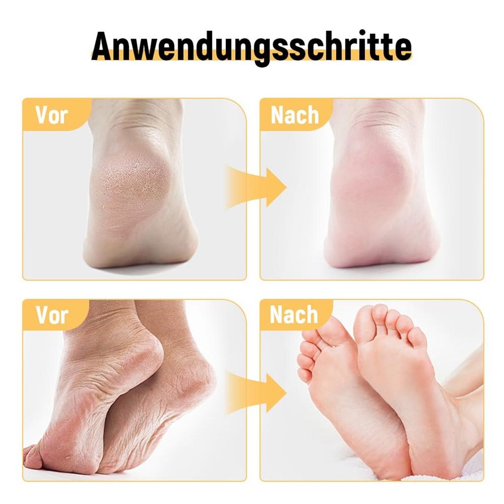 60% Urea Plus 2% Salicylsäure Fußcreme Feuchtigkeitscreme für trockene rissige Füße Knie Ellbogen Hände Hydriert & Nährt Fußpflege