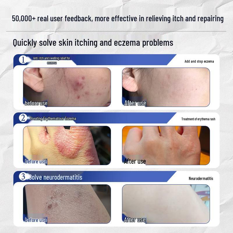 Jiubu Pharmaceutical Multi-Purpose Itch Relief Cream