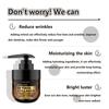 Eelhoe Face Cream Retinol Face Cream Remove Dark Spots Whitening Face Care Moisturizing Anti-Aging Firming Skin Care Cosmetics 100ml