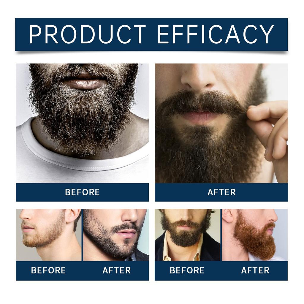 Beard Face Wash ,Beard Shampoo , Men's Beard Cleansing , Designed To Promote Healthy Beard Growth And Help Improve Beard Quality.
