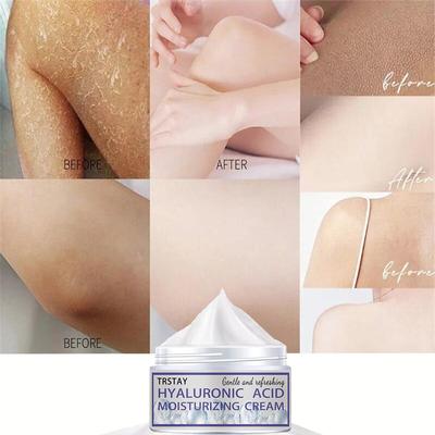 Whitening Cream, Darkening and Brightening the Skin, Nourishing and Hydrating, Even Skin Tone, Moisturizing Cream
