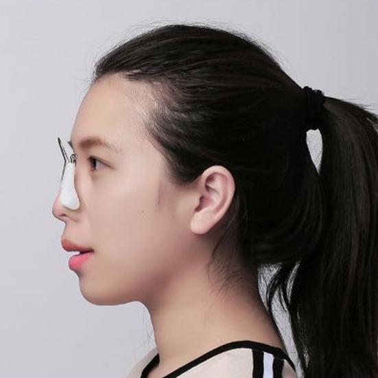 Nose Up Lifting Bridge Straightening Shaping Clip Corrector Shaper Beauty Tool