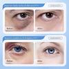 1-3boxes Hyaluronic Acid Serum Microneedling Serum For Face, Hyaluronic Acid Anti-aging Repair Serum 15pcs/box