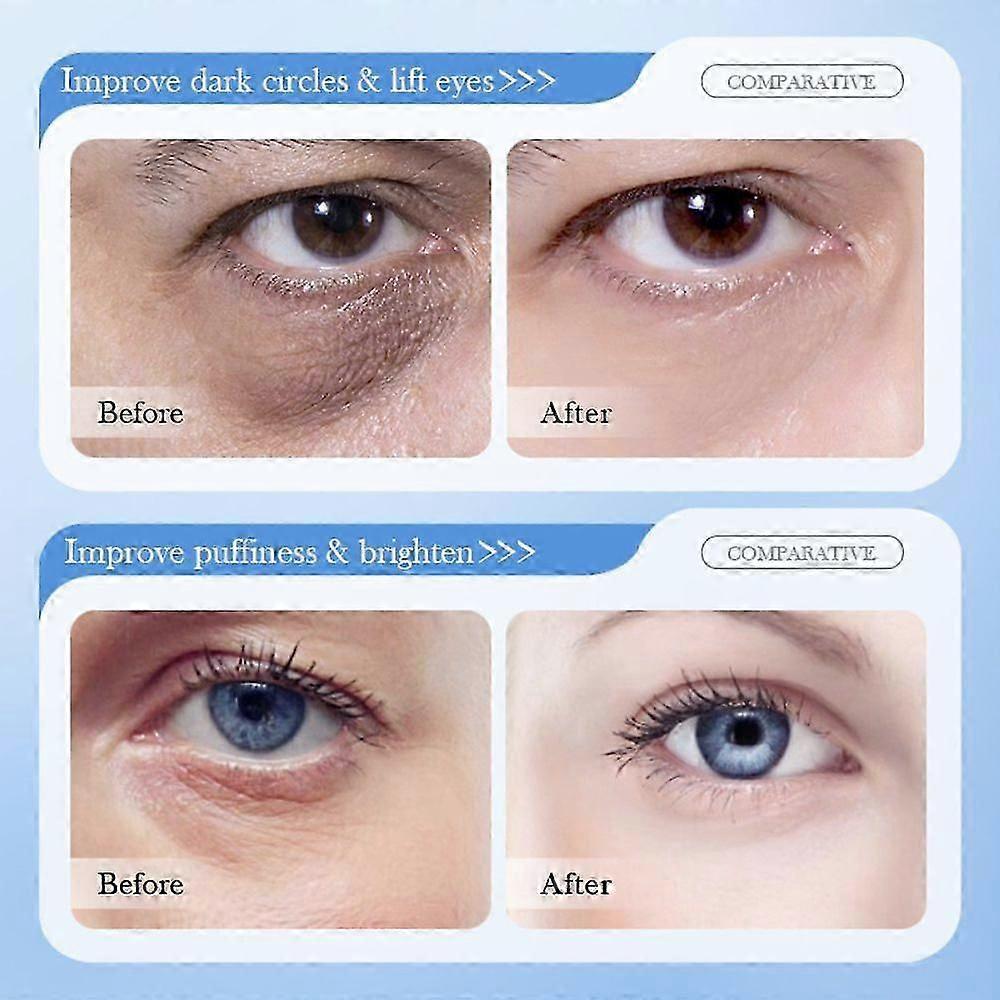 1-3boxes Hyaluronic Acid Serum Microneedling Serum For Face, Hyaluronic Acid Anti-aging Repair Serum 15pcs/box