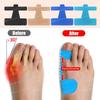 30Pcs Toe Separator Hallux Valgus Fixed Support Protect Toes Anti Rubbing Toe Protective Patch for Big Toe Correction Valgus