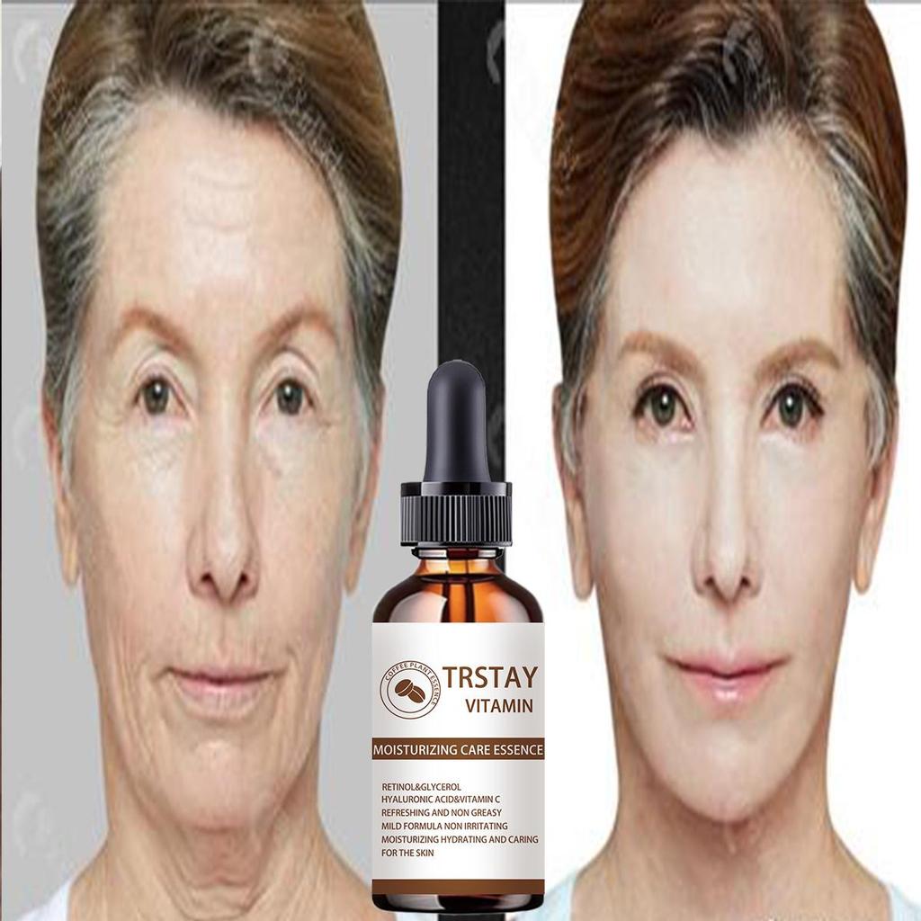 5G/15G/30G/50G/Lighten Black Spot Face Cream Whitening and Brightening Inhibits Antioxidation and Improves Drying