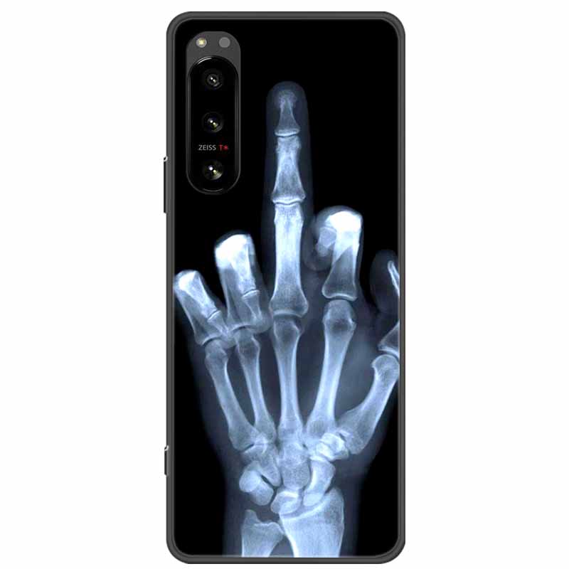 Pro Sony Xperia 5 / 5 II / 5 III Pouzdro TPU Měkký Silikon Nárazuvzdorná Pouzdra pro Sony Xperia 5 III Kryt Telefonu 5II 5III Vlk Lvi