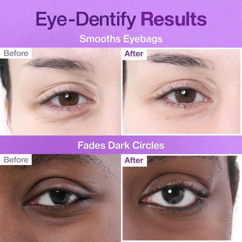 NUMBUZIN N°9 Patchs Yeux (5ch)