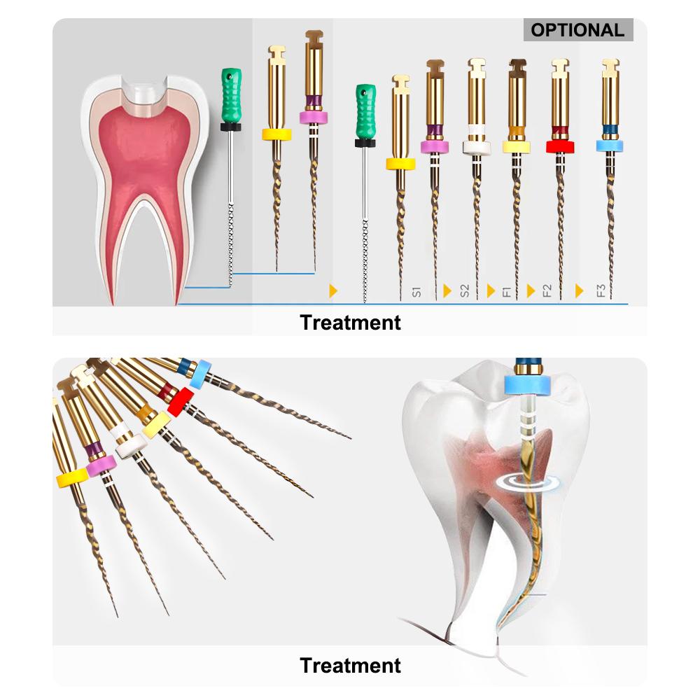 6 szt./pudełko Złote elastyczne pilniki dentystyczne, obrotowe pilniki endodontyczne, złote pilniki endodontyczne, 21/25/31 mm, niklowo-tytanowe, narzędzie stomatologiczne