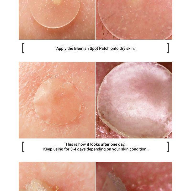 Elizavecca - Witch Piggy Hell Pore Blemish Spot Patch