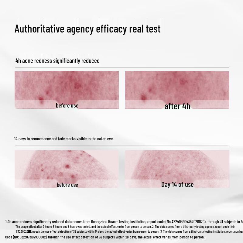 Hiruscar Azelaic Acid Acne Essence Cream