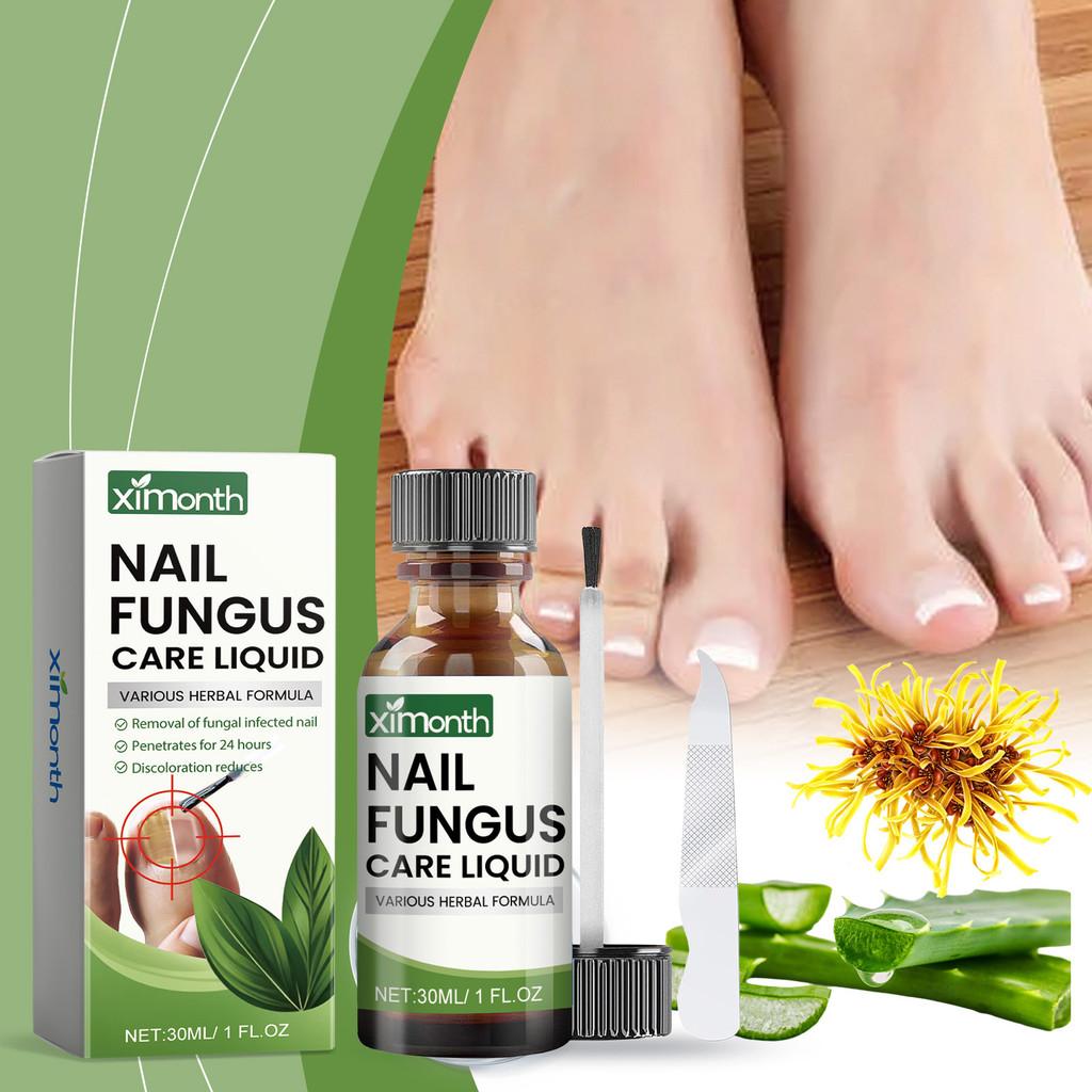 Ximonth Advanced Toenail And Fingernail Repair Set For Healthy Beautiful Nails Care