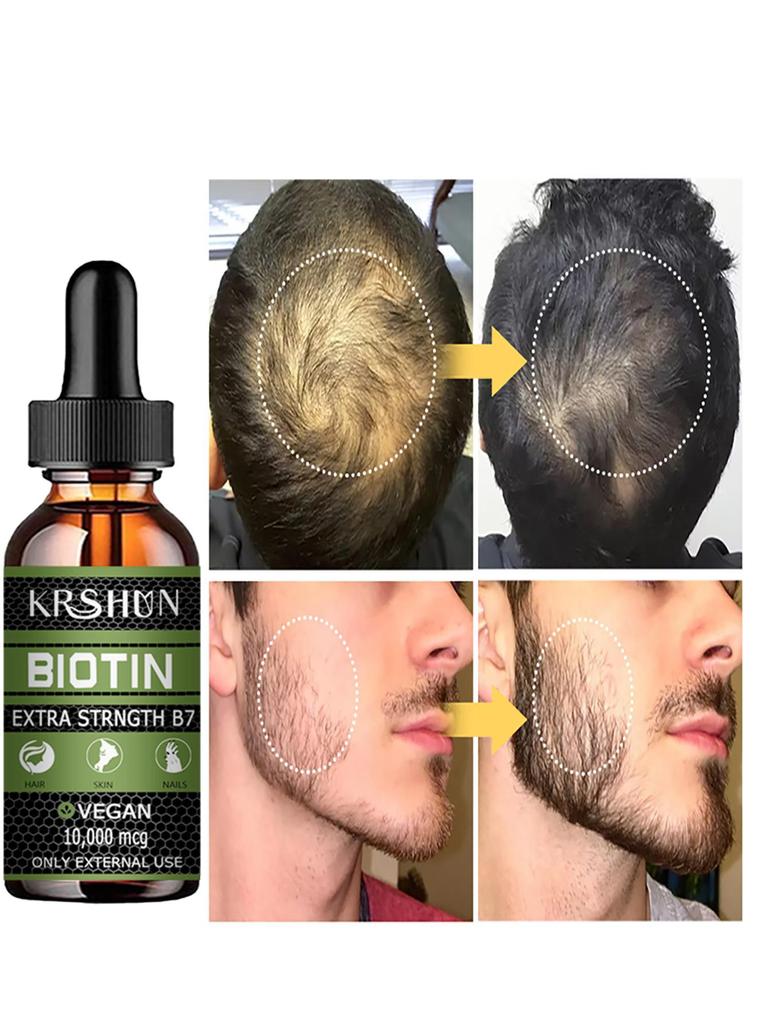 Huile de croissance capillaire entièrement naturelle pour rendre les cheveux plus épais et plus longs et stimuler la croissance des cheveux Produits capillaires Huile de croissance pour femmes noires