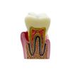 Big Dental Teeth Model Anatomy Large Dental Anatomical Model For Teaching Studying Education Demonstration Patient Communication