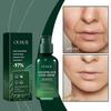 Limited time!!Ouhoe Facial Essence Moisturizes, Hydrates, Hydrates And Brightens The Skin, Providing Gentle Care For The Facial Skin