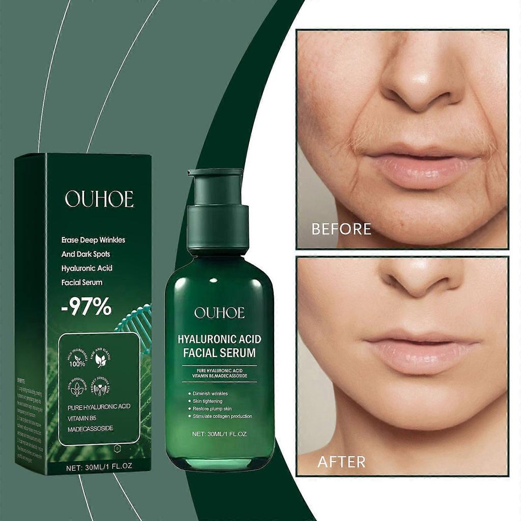 Limited time!!Ouhoe Facial Essence Moisturizes, Hydrates, Hydrates And Brightens The Skin, Providing Gentle Care For The Facial Skin