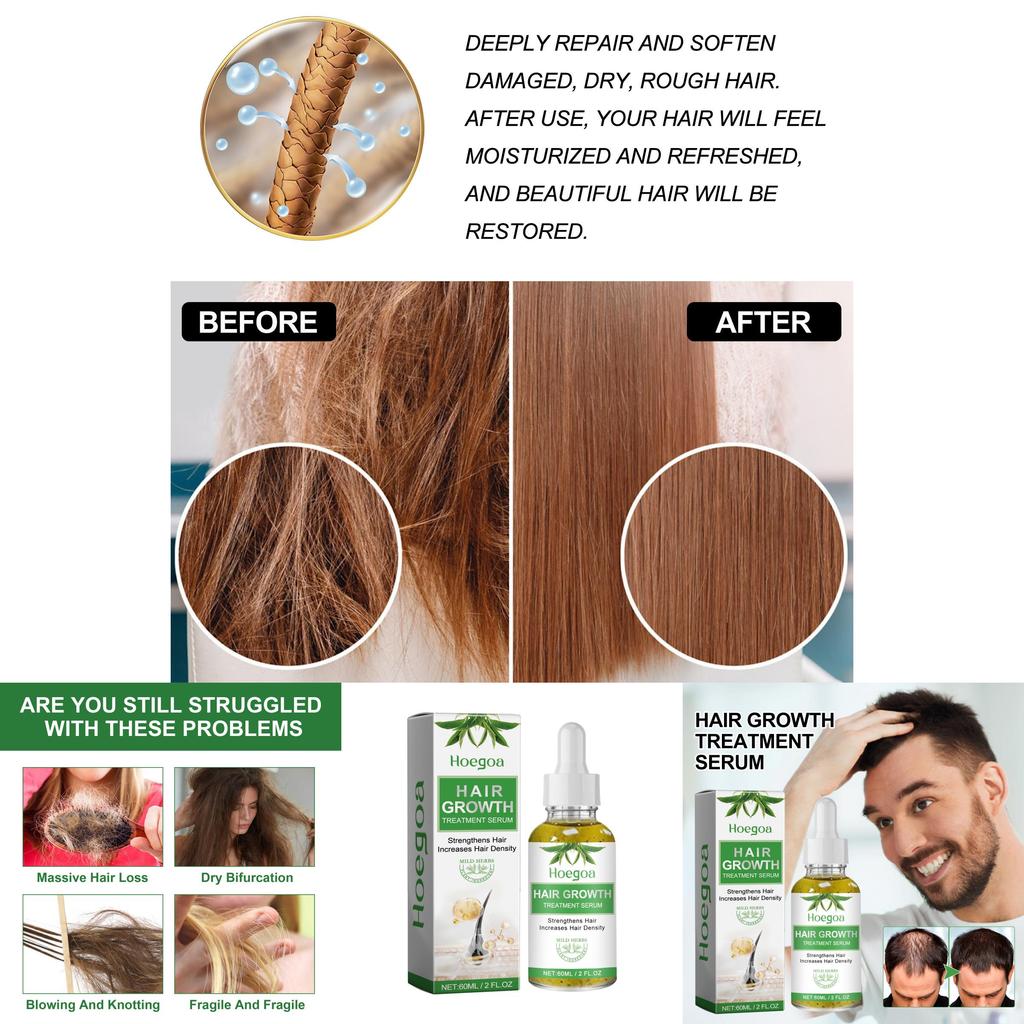 Hoegoa 60ml For Strong Resilient Hair With Natural Fragrance And Non-greasy Finish