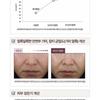 CENTELLIAN24 Expert Madeca Mela Capture Ampoule Max