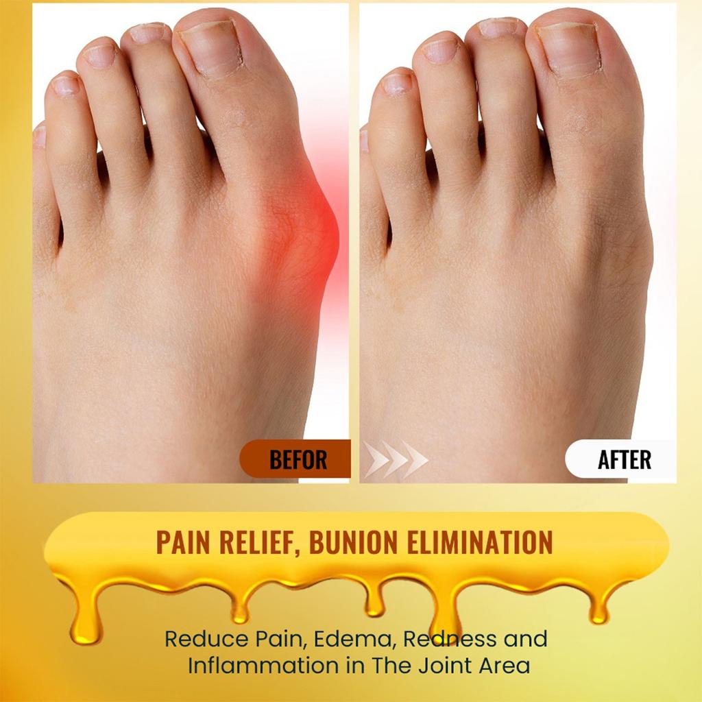 Bee Thumb Heat Care Massage Relieving Toe Muscle And Pain Promotes Blood Circulation A Plaster That Relieves Fatigue