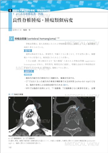 First of All, Let's Start with the Basics: Spinal Imaging Diagnosis