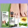 Ximonth Fortgeschrittenes Nagelreparatur-Set für Zehen- und Fingernägel für gesunde, schöne Nägel Pflege
