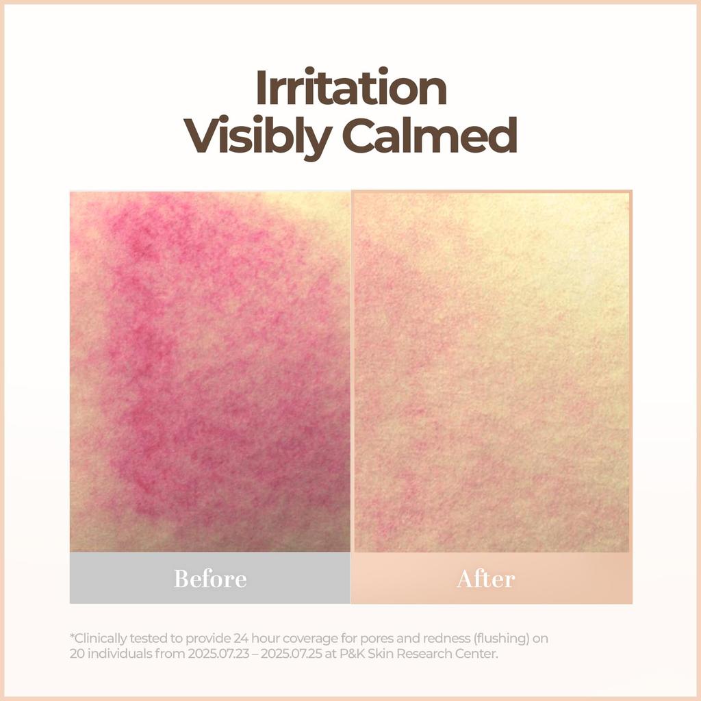 Selffusion C Skin Blemish Balm Intensive 30ml (Light)