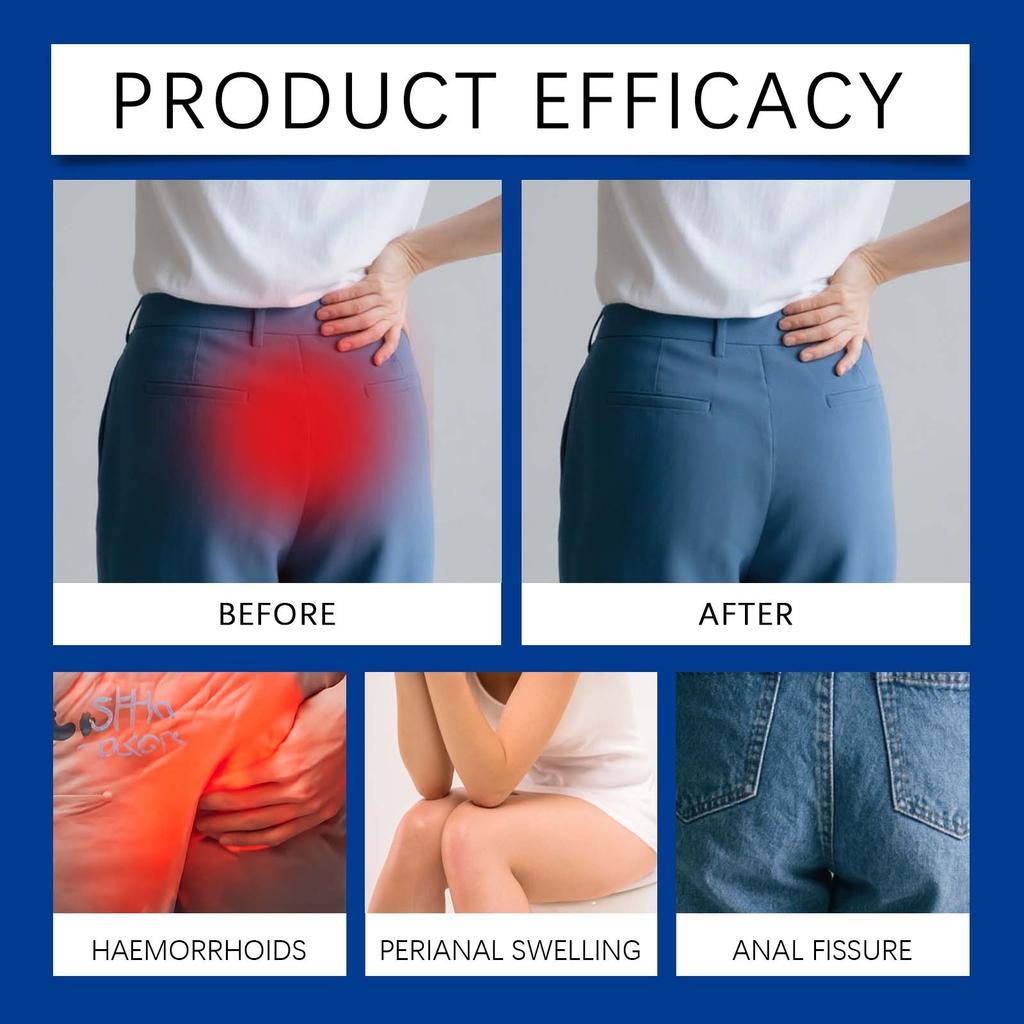 Comfort Ointment Cream Relieves Perianal Pain And Improves Itching And Discomfort