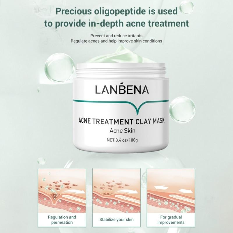 Acne Treatment With Clay Powder