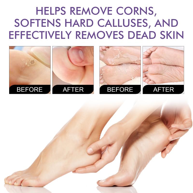 Lavender Foot Mask Powerfully Exfoliate And Remove Dead Skin, Foot Mask For Dry Cracked Feet