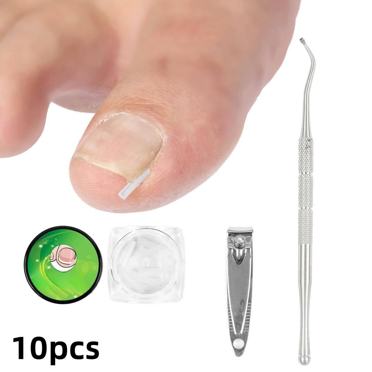 

Инструмент для коррекции ногтей на ногах Эластичный пластырь для лечения ногтей на ногах Выпрямляющий зажим для скоб Инструмент для педикюра 10-pcs