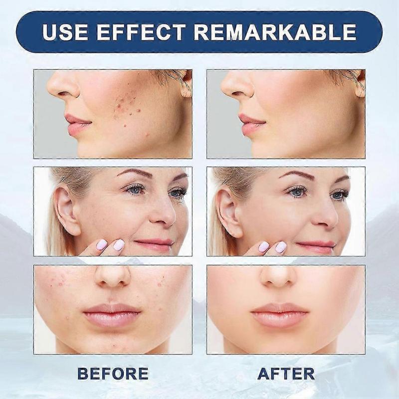 Collagen Wrinkle Removal Liquid Solution Anti-Aging Serum for All Skin Types