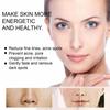 Acne and Spot Removing Cream Lightens Spots Brightens Skin Tone Moisturizes Skin Acne and Spots Skin Care and Repair Cream