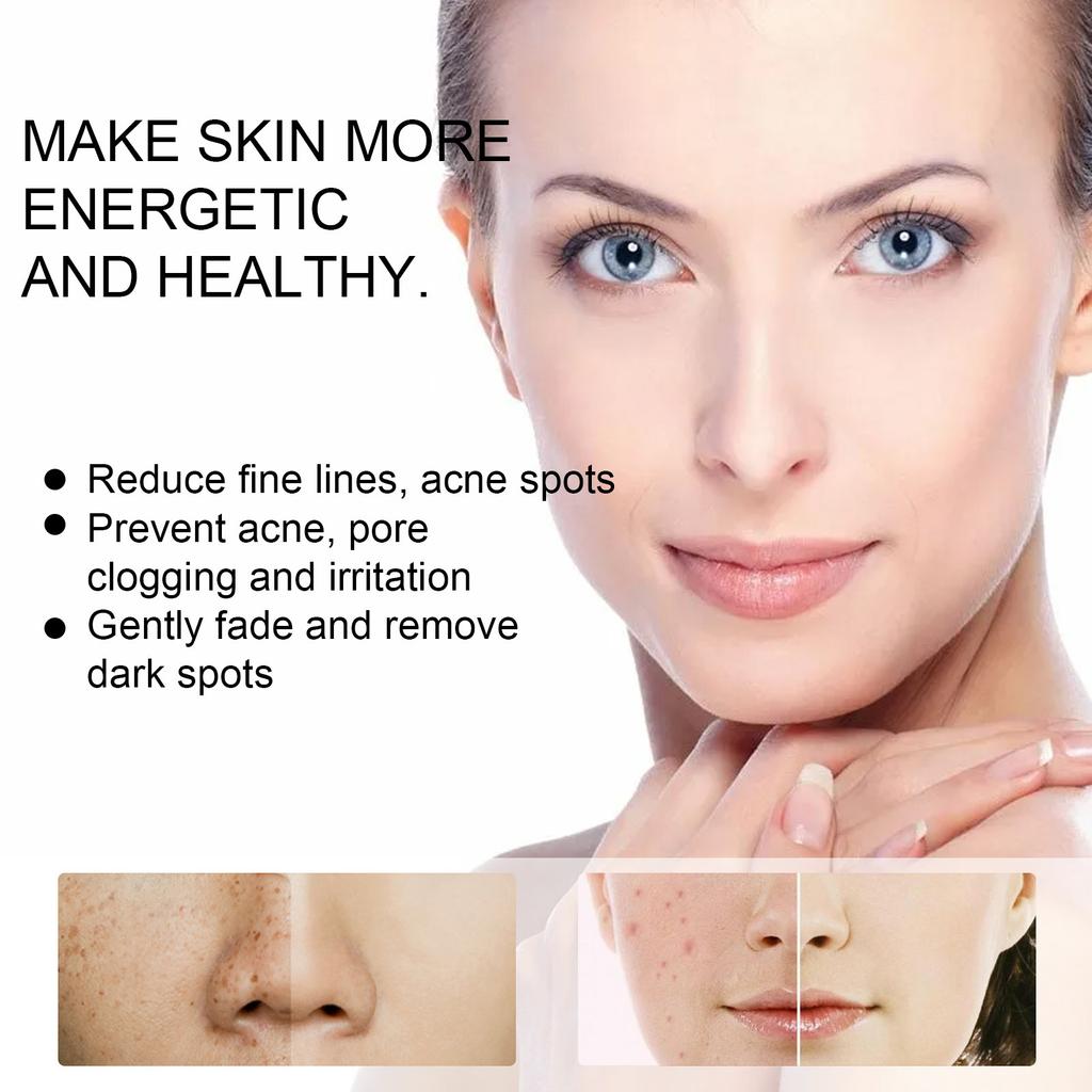 Acne and Spot Removing Cream Lightens Spots Brightens Skin Tone Moisturizes Skin Acne and Spots Skin Care and Repair Cream