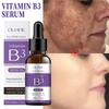 Hoygi Niacinamid Gesichtsserum Vitamin B3 Falten Pigment Dunkle Flecken Entfernung Korrigierendes Glow Serum Gesichtsaufhellung Feuchtigkeitscreme