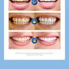 Remove Stains Toothpaste 100g SADOER Deep Cleaning Coffee Stains Tea Stains Tooth Protector